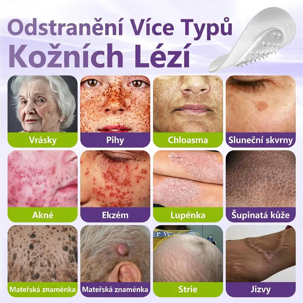 GFOUK® | 🇨🇿🩺 Rozpustná botanická mikrojehličková náplast na odstranění kožních výrůstků a znamének 🧪🌿 — Odstraní výrůstky za pouhých 5 dní, bezbolestně a bez jizev